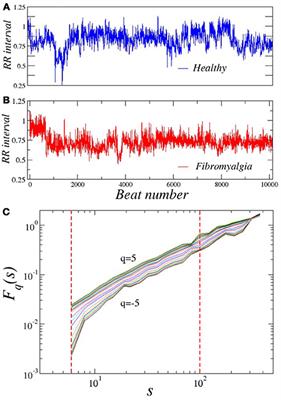 Multifractal Analysis Reveals Decreased Non-linearity and Stronger Anticorrelations in Heart Period Fluctuations of Fibromyalgia Patients